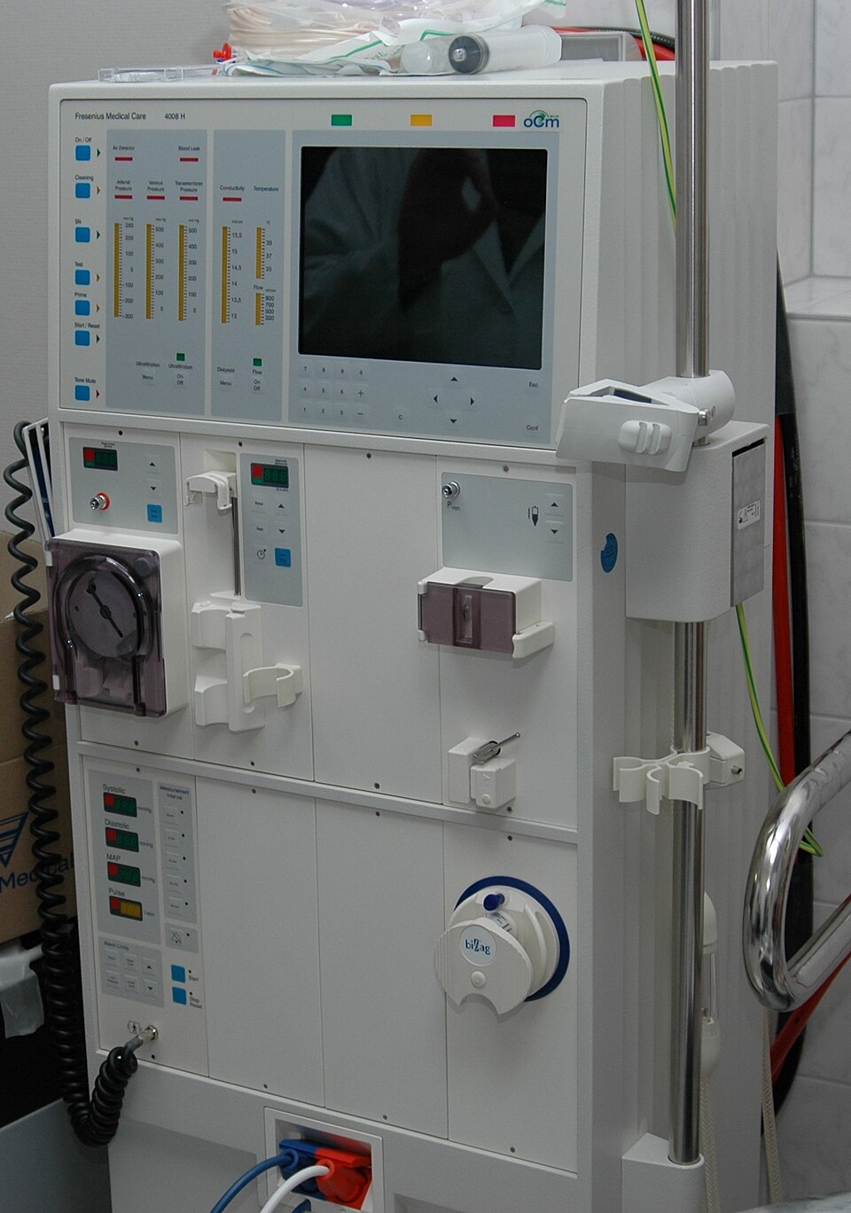 Hemodialysis - Wikipedia
