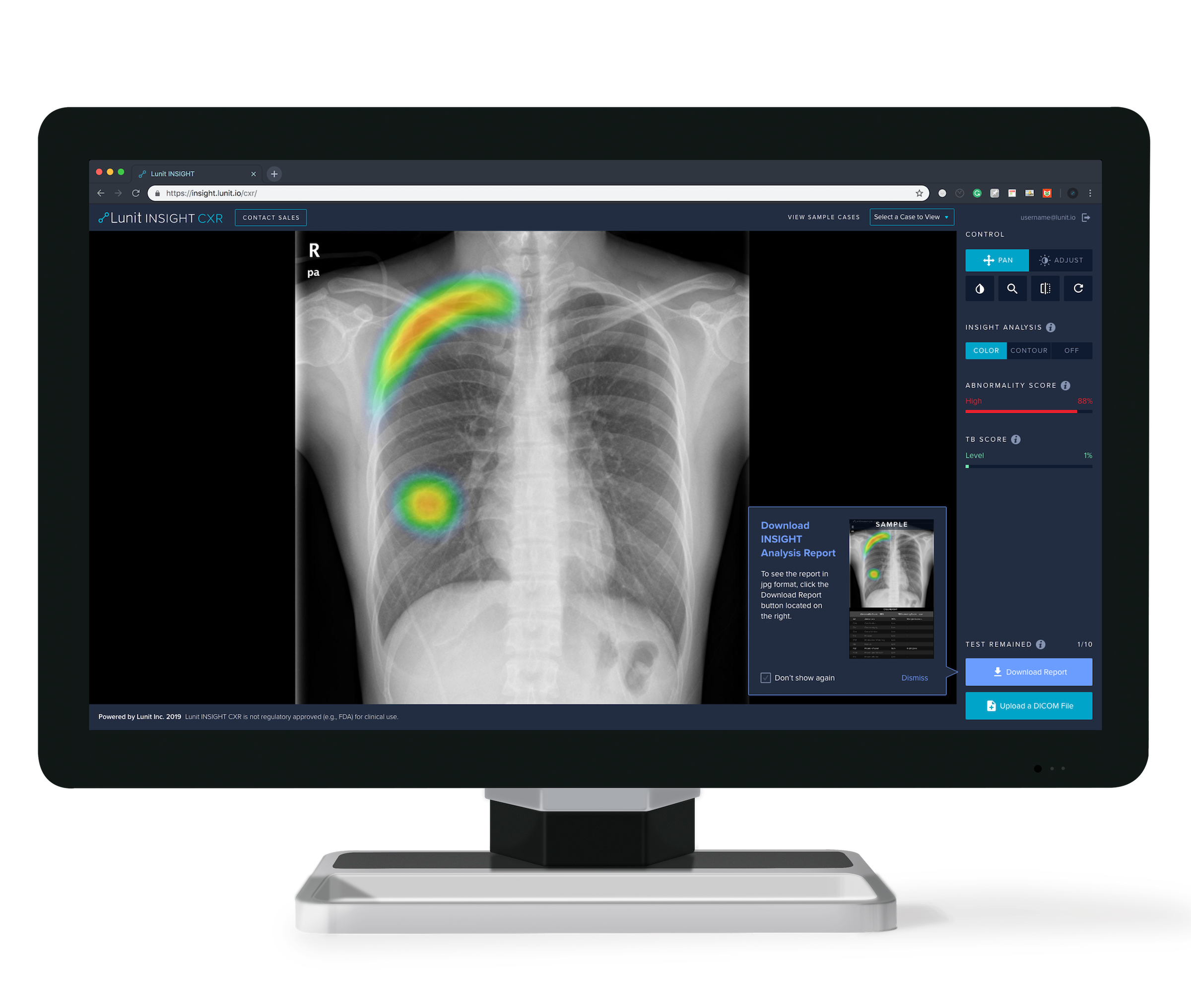 Lunit Announces its First CE Mark for AI-Powered Chest X-ray Analysis Software, Lunit INSI