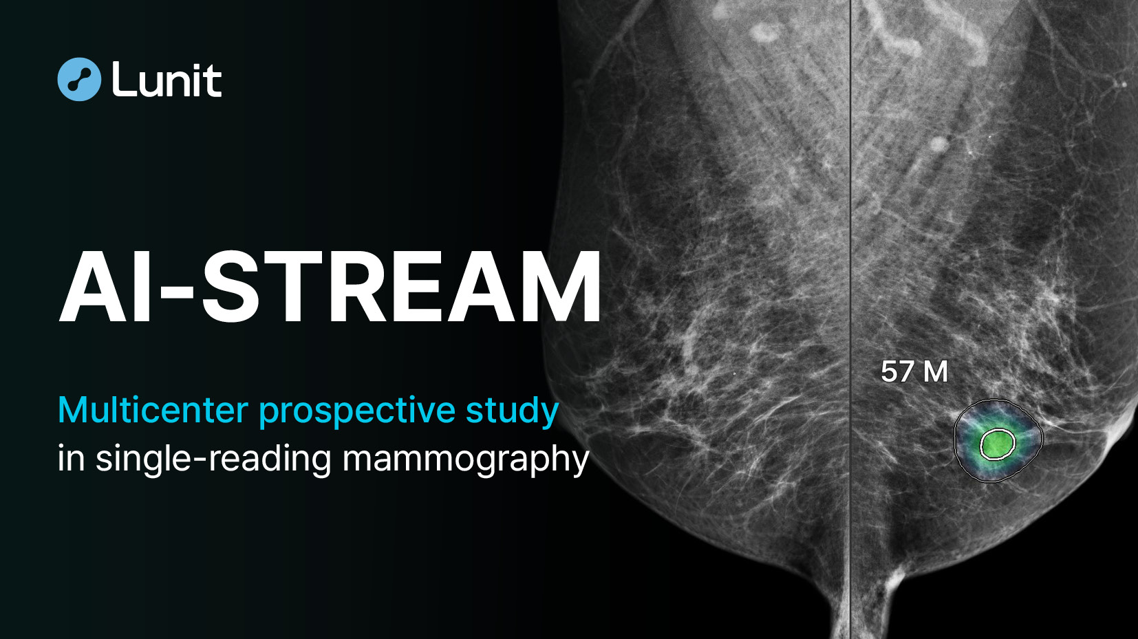 World's First Large-Scale, Multicenter Prospective Study in Single ...