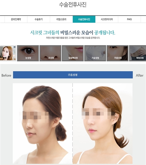 공정위, 수술비 대가 후기를 숨긴 성형외과 3곳 제재