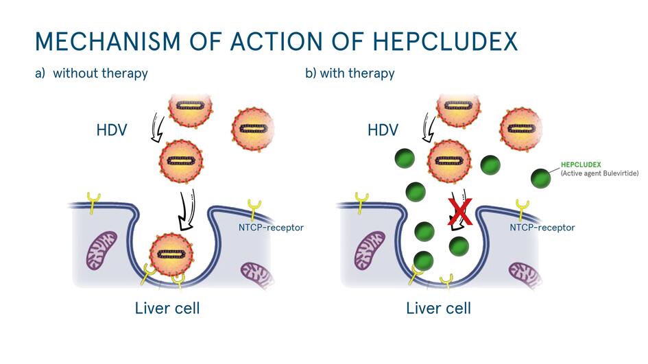 길리어드 HDV 치료제 헤플루덱스 FDA 승인에 주가 상승